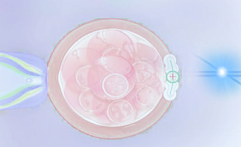 დამხმარე ჰეთჩინგი (hatching)